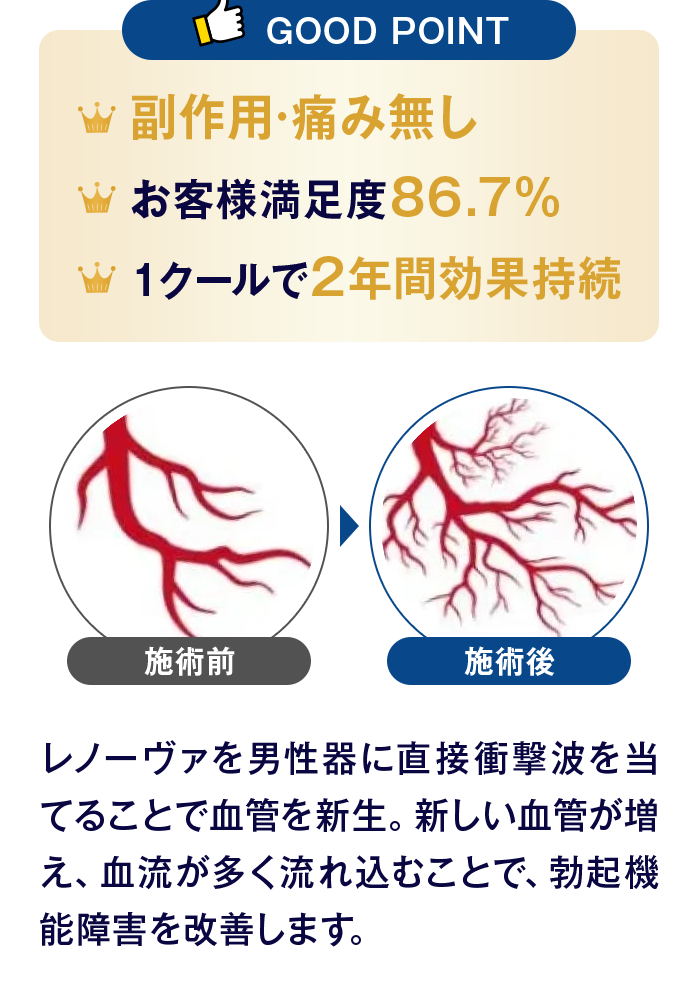【GOOD POINT】副作用·痛み無し/お客様満足度86.7%/1クールで2年間効果持続｜レノーヴァを男性器に直接衝撃波を当てることで血管を新生。新しい血管が増え、血流が多く流れ込むことで、勃起機能障害を改善します。