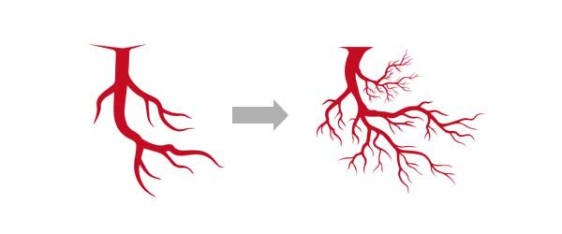 レノーヴァは、このように生じるEDに対して改善の効果