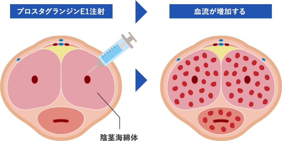 レノーヴァ治療のメカニズム