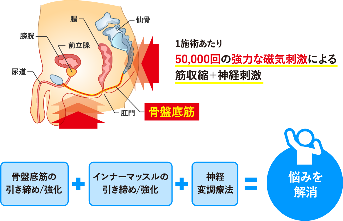 スターフォーマー治療のメカニズム