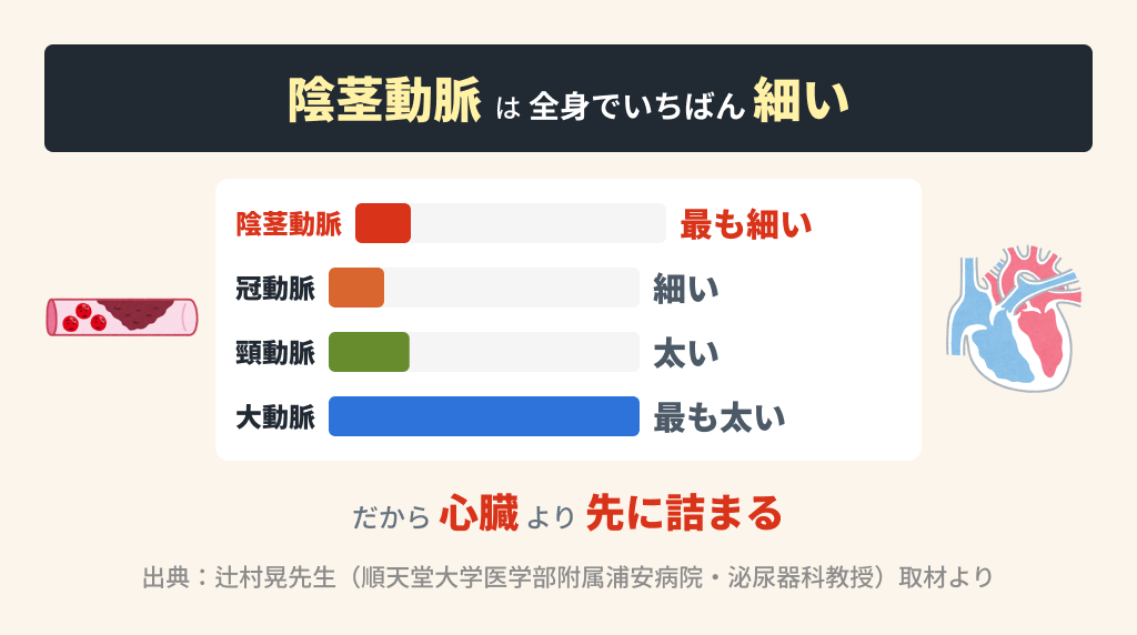 陰茎動脈と全身動脈のサイズ比較・ED→心筋梗塞のタイムライン
