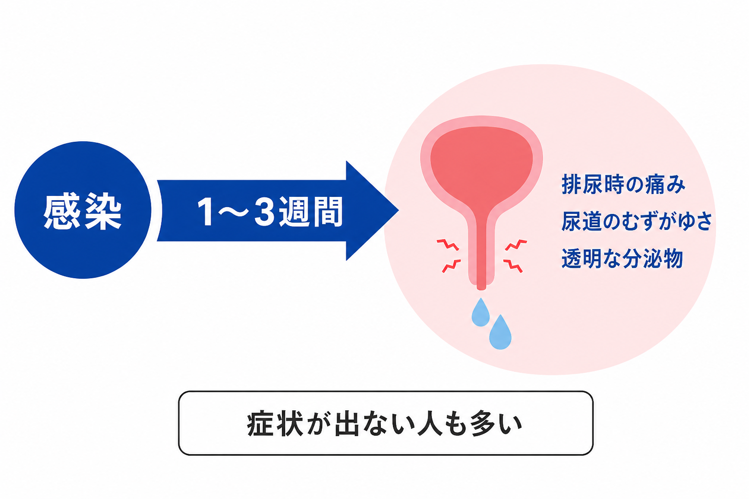 クラミジアは感染から1〜3週間で排尿時の痛み・尿道のむずがゆさ・透明な分泌物が出る。症状が出ない人もいる